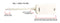 DSL Phone Line Filter | 1 Pack | Ivory | Reduce Digital Noise Caused By DSL Line