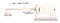 2 Wire, 1 Line DSL Filter - for removing noise and other problems from DSL related phone lines